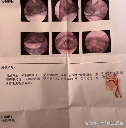 每次使用后要清洗并晾干霧化器 守護(hù)療效與健康的關(guān)鍵一步